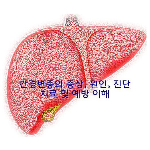 간경변증의 증상, 원인, 진단, 치료 및 예방 이해