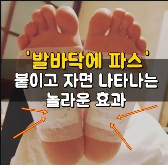 발바닥 파스 효과와 붙이는 위치 방법 팁 정리_15