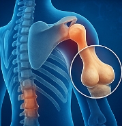 골다공증에 좋은 음식