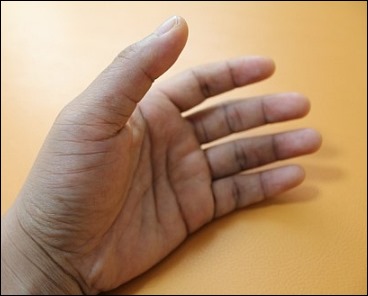 손가락 마디 통증 6