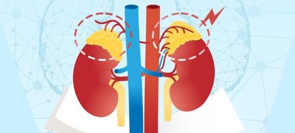 부신백질 이영양증