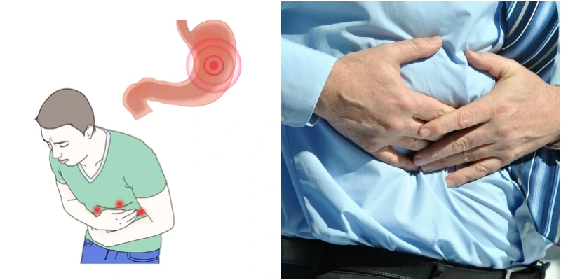 기스트암 증상 중 복통