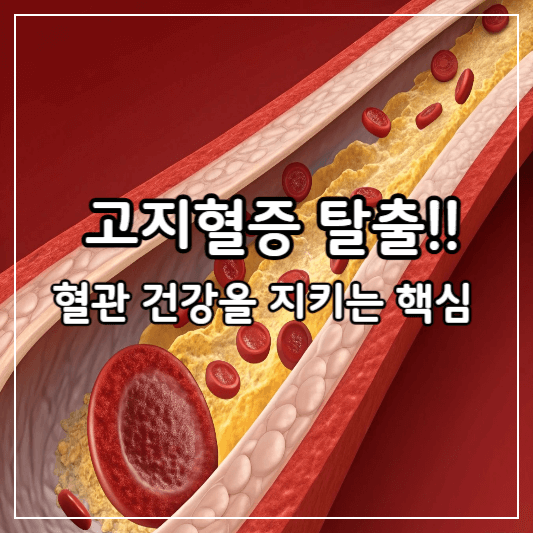 고지혈증-썸네일