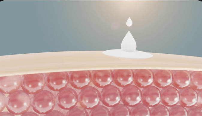 콜라겐 재생을 돕는 쥬베룩(PDLLA) 효과와 가격 정보&amp;#44; 주의사항 바로알기!