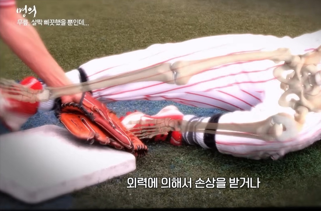 퇴행성-관절염-김성환-교수