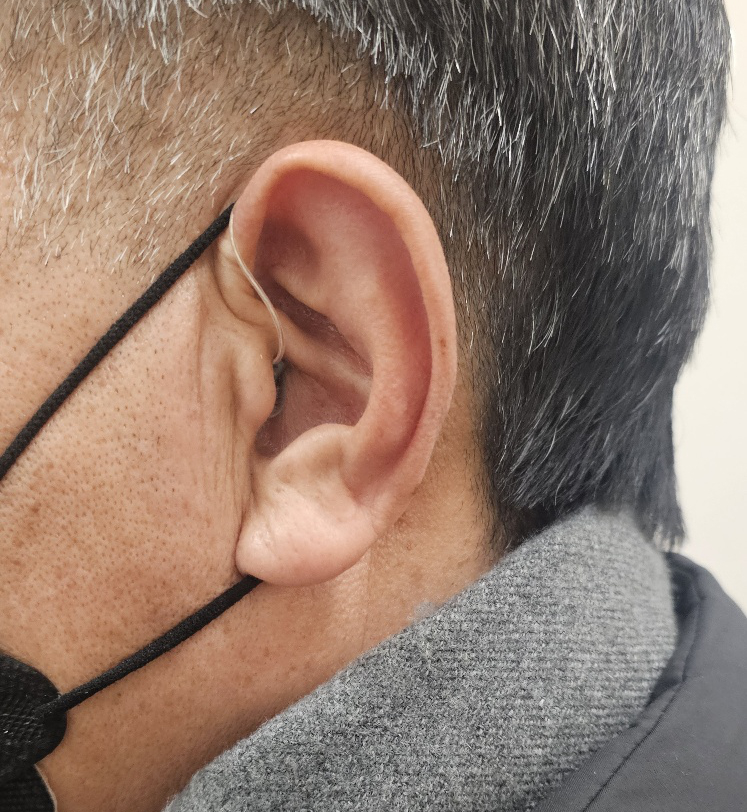 이명 보청기 착용하진