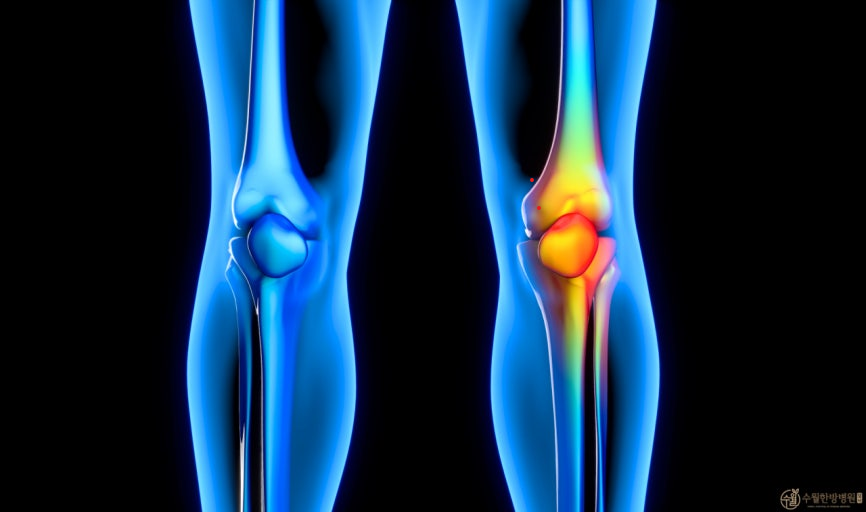 무릎 관절을 부드럽게 풀어준다