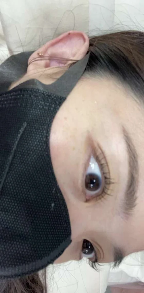 오프네일