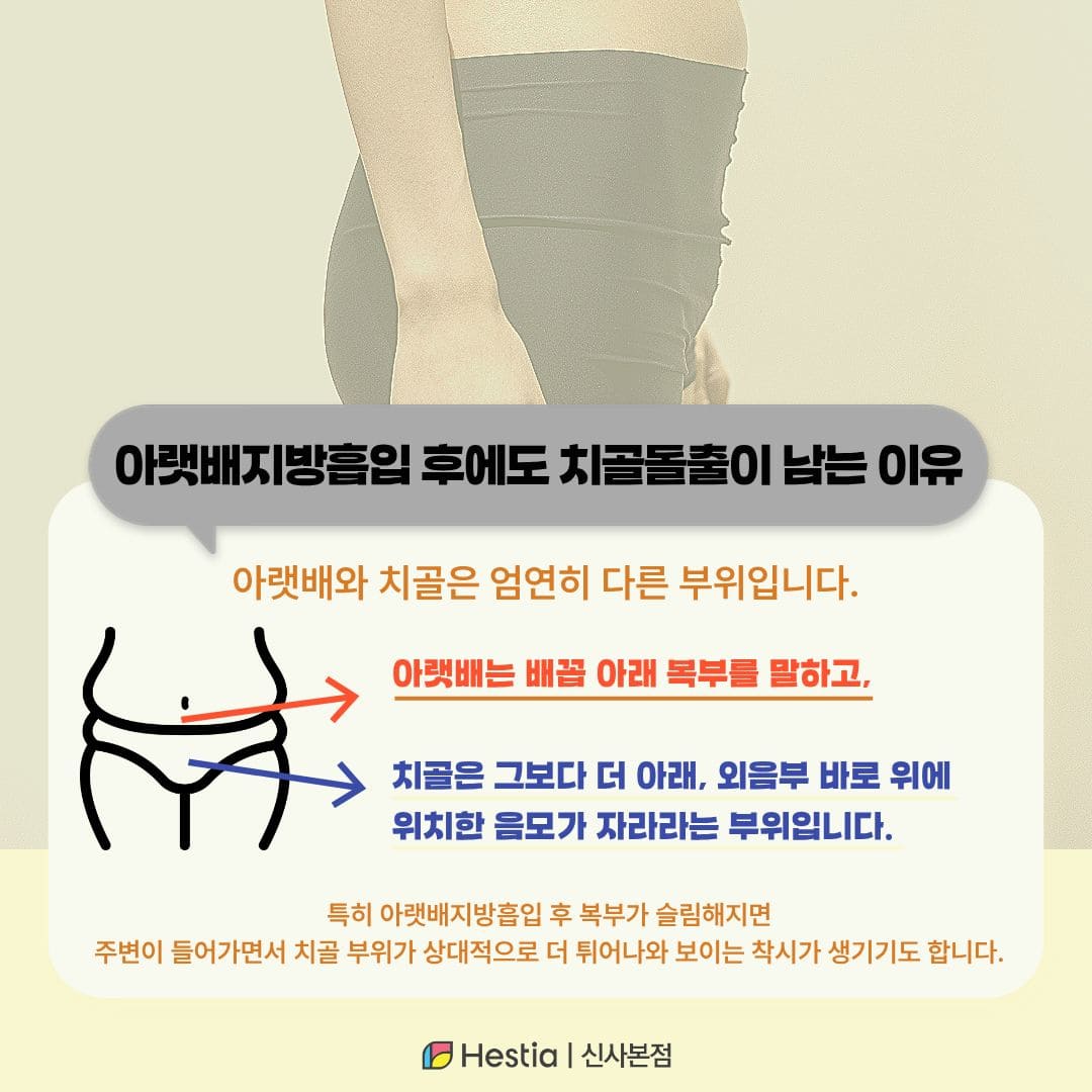 아랫배 지흡 후에도 Y존이 그대로인 이유
