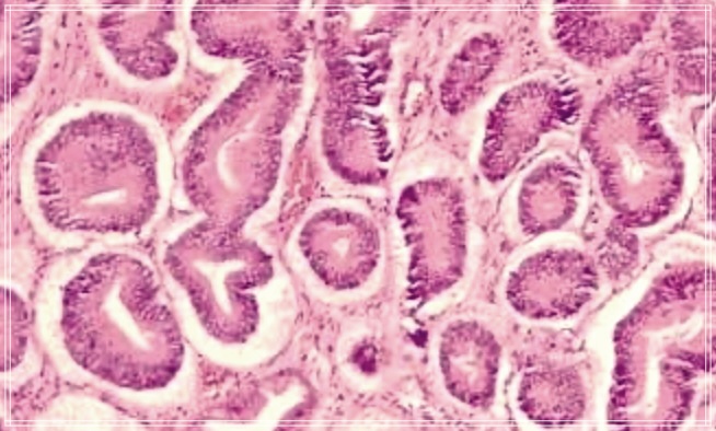 양성 종양과 악성 종양의 차이점