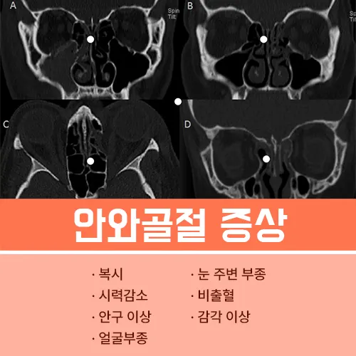 안와골절 증상