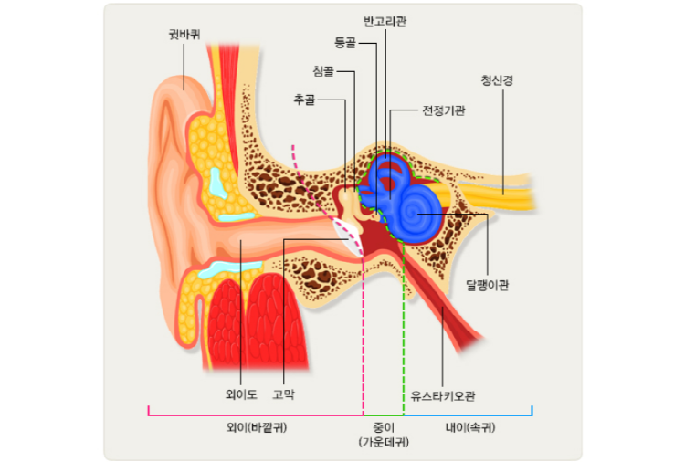 이석증