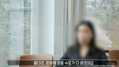 약물알레르기