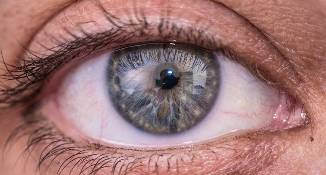 Cataract