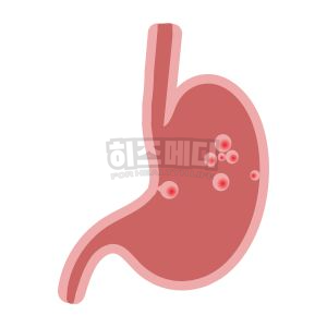 위내시경 전날 음식 금식시간