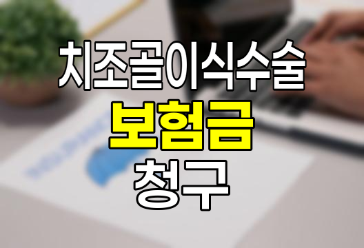 치조골이식수술 보험금 청구 핵심 정보
