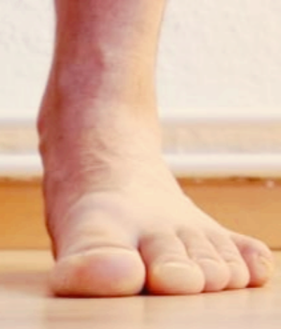 발저림 원인 증상, 치료법과 병원 선택까지