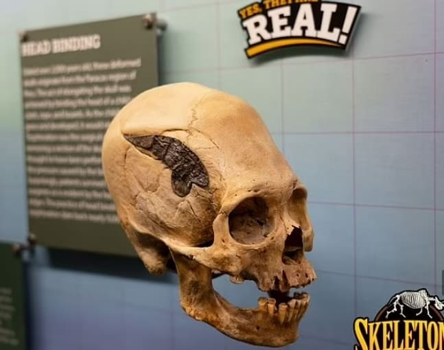 2천년 전 페루인들의 놀라운 수술 기술 VIDEO: 2,000 year-old Peruvian skull may be oldest evidence of SURGERY...