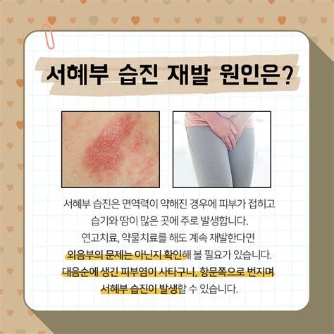 남자 사타구니 습진