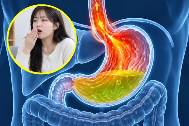 위산과다 신물 트림