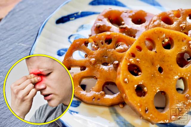 코막힘 뚫는법 코막힘에 좋은음식 연근