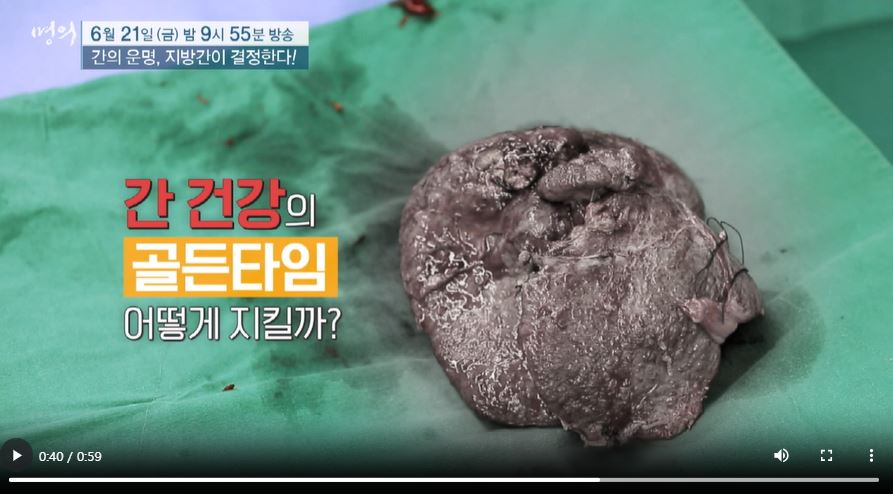 명의 지방간 원인 예방