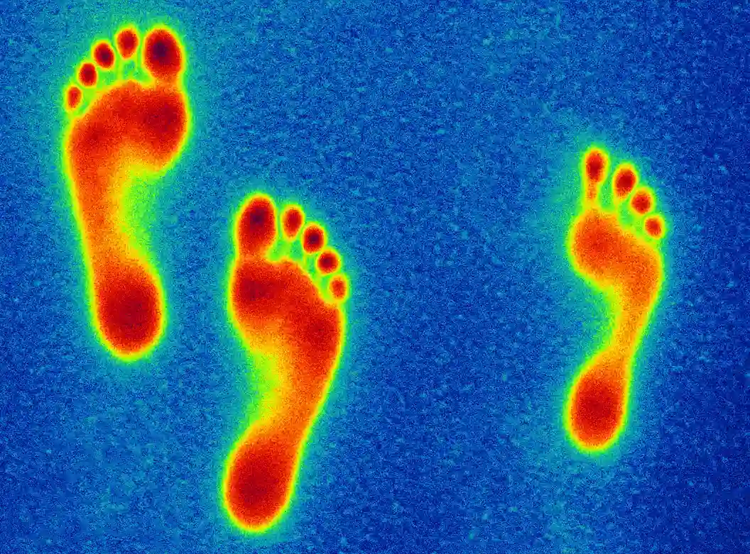 일반 보행과 오른쪽 엄지발가락 상실로 불균형한 보폭