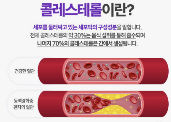 콜레스테롤 정상수치