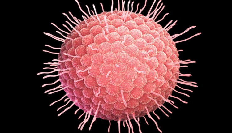 수두의 원인균 Varicella-Zoster 바이러스(VZV)