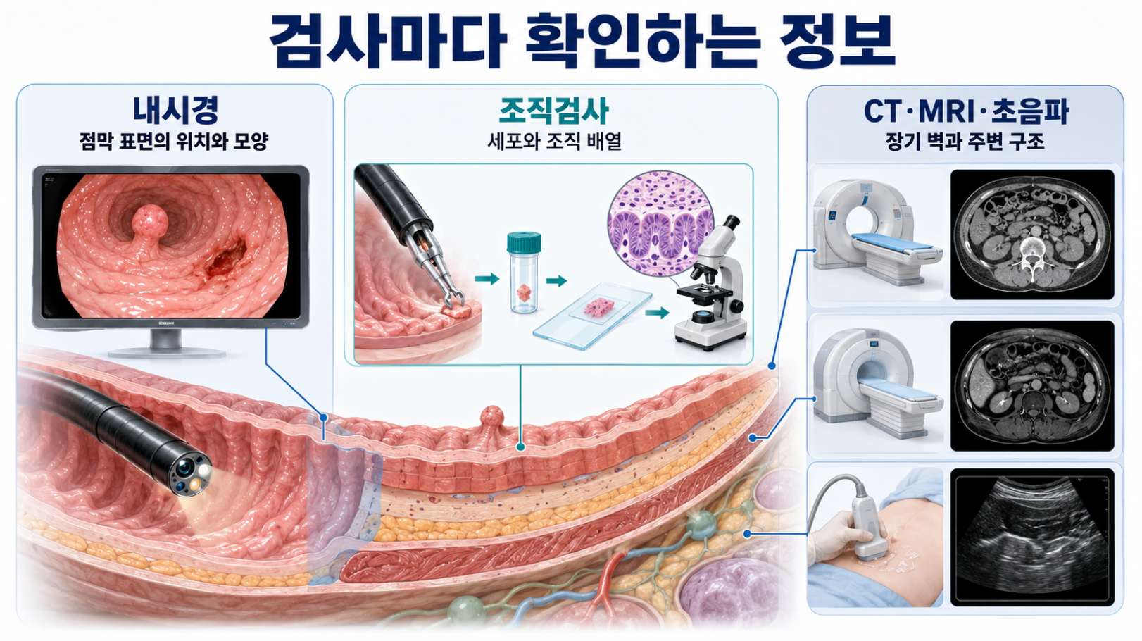 내시경&middot;조직검사&middot;CT&middot;MRI&middot;초음파가 확인하는 정보 범위 비교