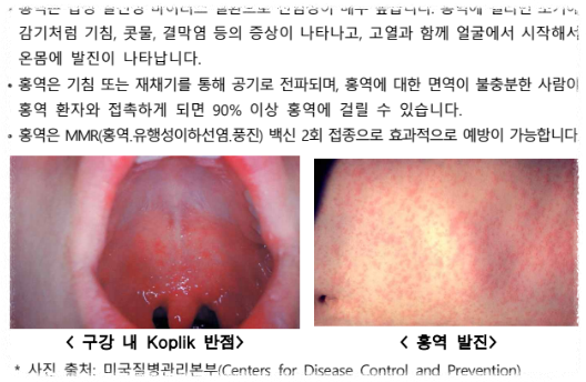 홍역 주요 증상