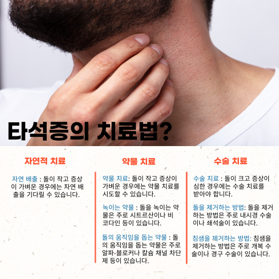 타석증-치료법