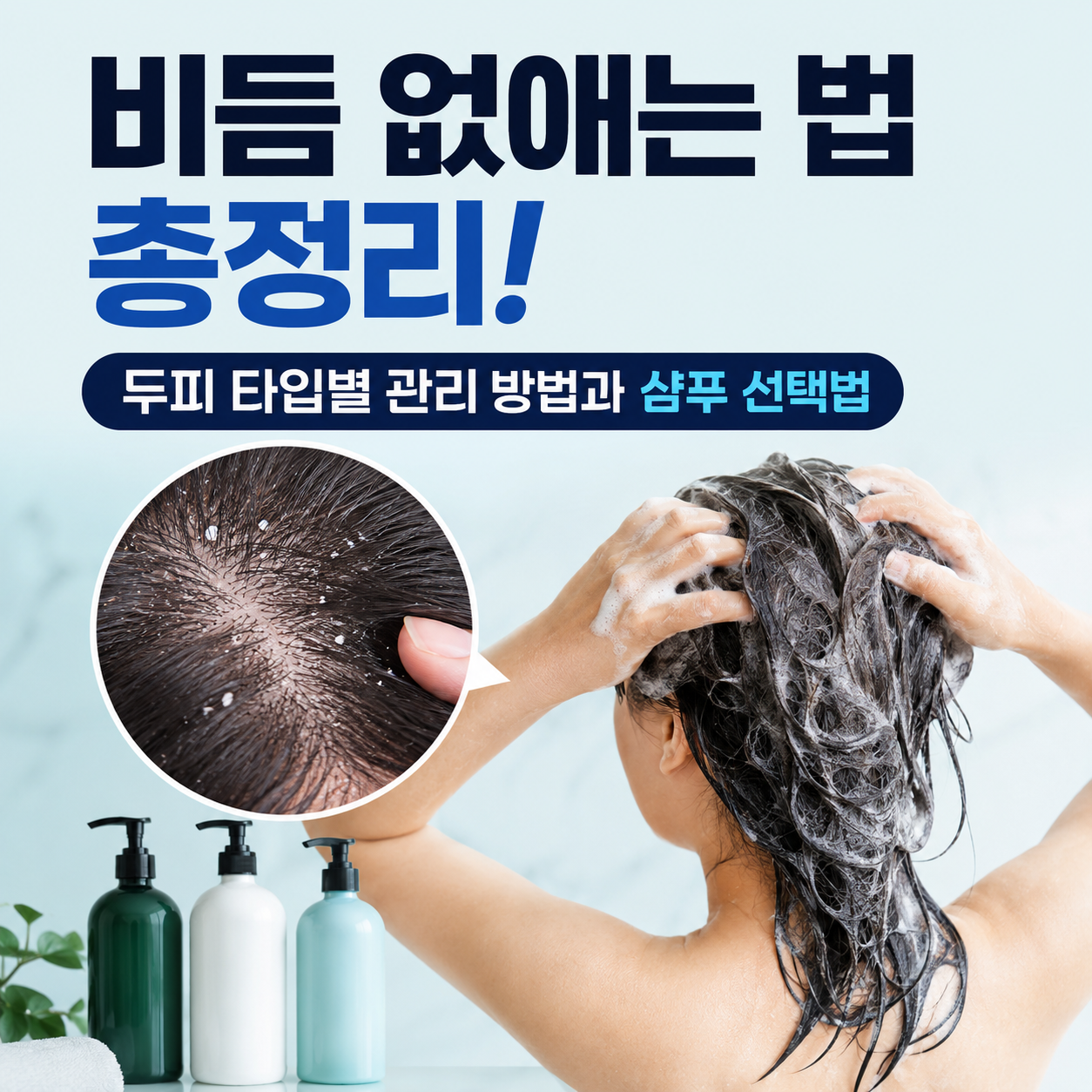비듬 없애는 법