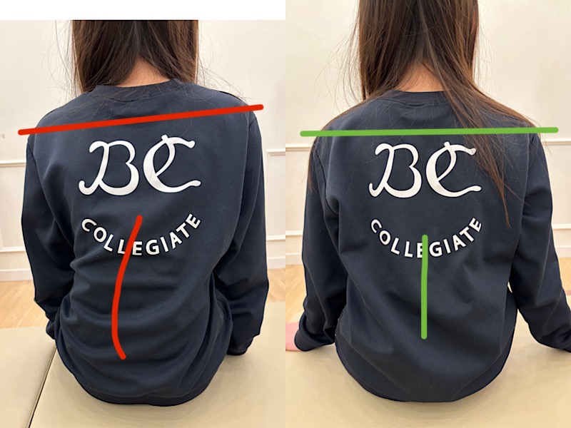 골반 틀어짐, 척추 측만증 교정할 수 있을까? 강사의 관점