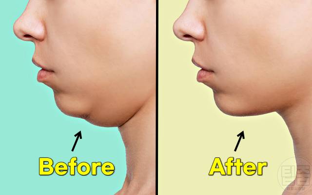 턱살 빼는법 턱살리프팅 운동 스트레칭 다이어트