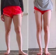 한방다이어트