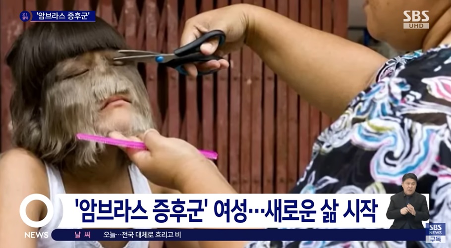 다모증 치료 후 변화