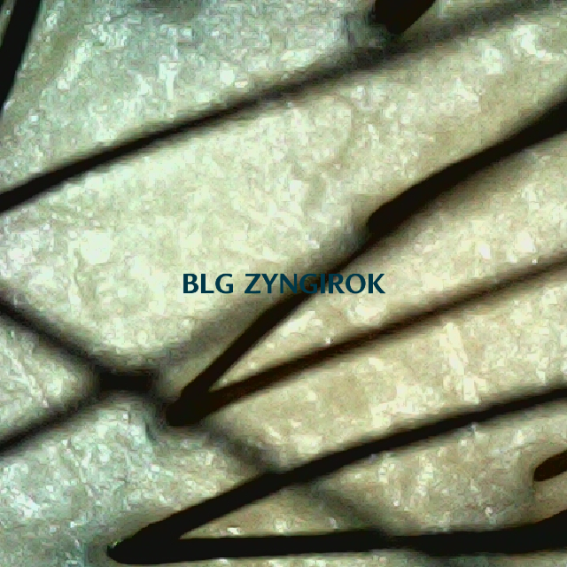 탈모 극복 프로젝트 - 정수리 두피모습이다.