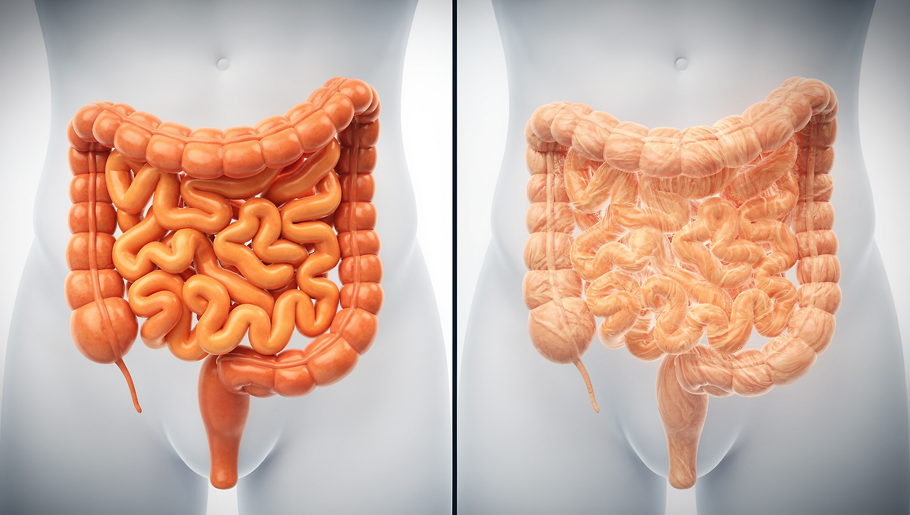 딱딱한변-원인-피-묽게-만드는-해결-방법