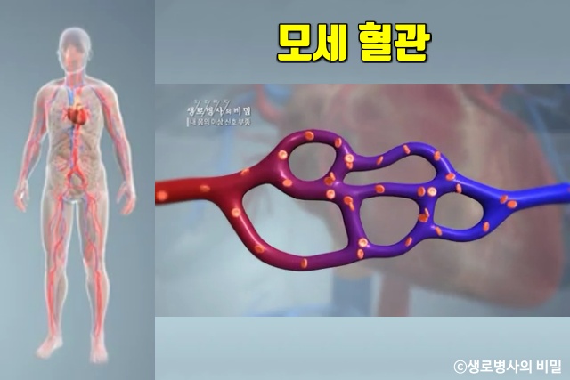 종아리 얼굴 붓는 이유, 붓기 부기 부종 원인 증상, 생로병사의 비밀, 다이어트 건강, 팁줌 매일꿀정보