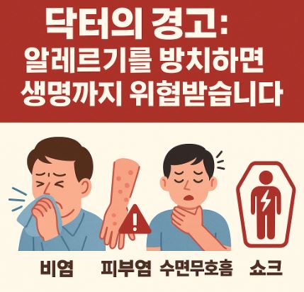 알레르기