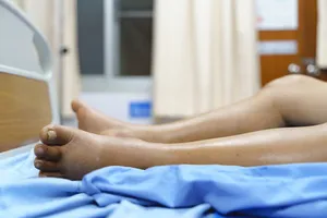 발목이-붓는-이유