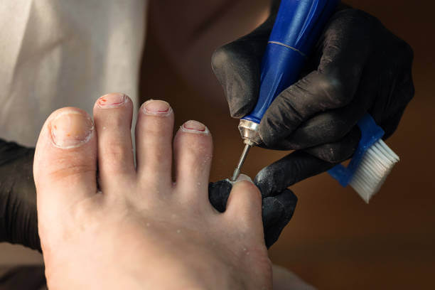 새끼발톱 갈라짐&amp;#44; 원인과 예방방법 때로는 작은 부위에 대한 관심 부족으로 인해 큰 문제가 발생할 수 있습니다. 이번 글에서는 새끼발톱이 갈라지는 이유와 예방 방법&amp;#44; 그리고 집에서 할 수 있는 치료 방법을 참고하시기 바랍니다. 이제부터 새끼발톱에 대한 지식을 쌓아 보세요.