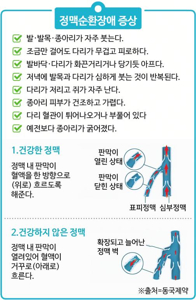 혈액순환개선제