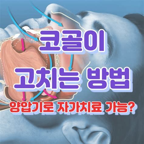 코골이 고치는 법