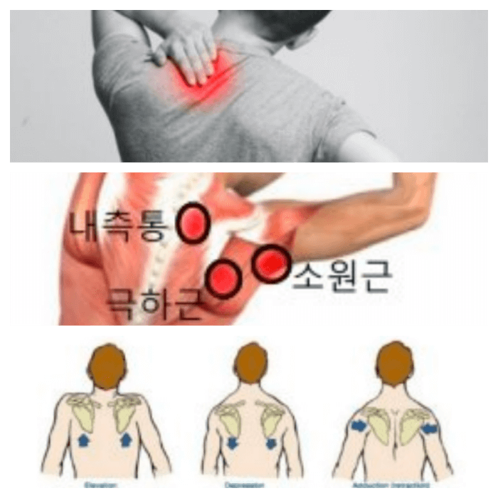 등의 통증