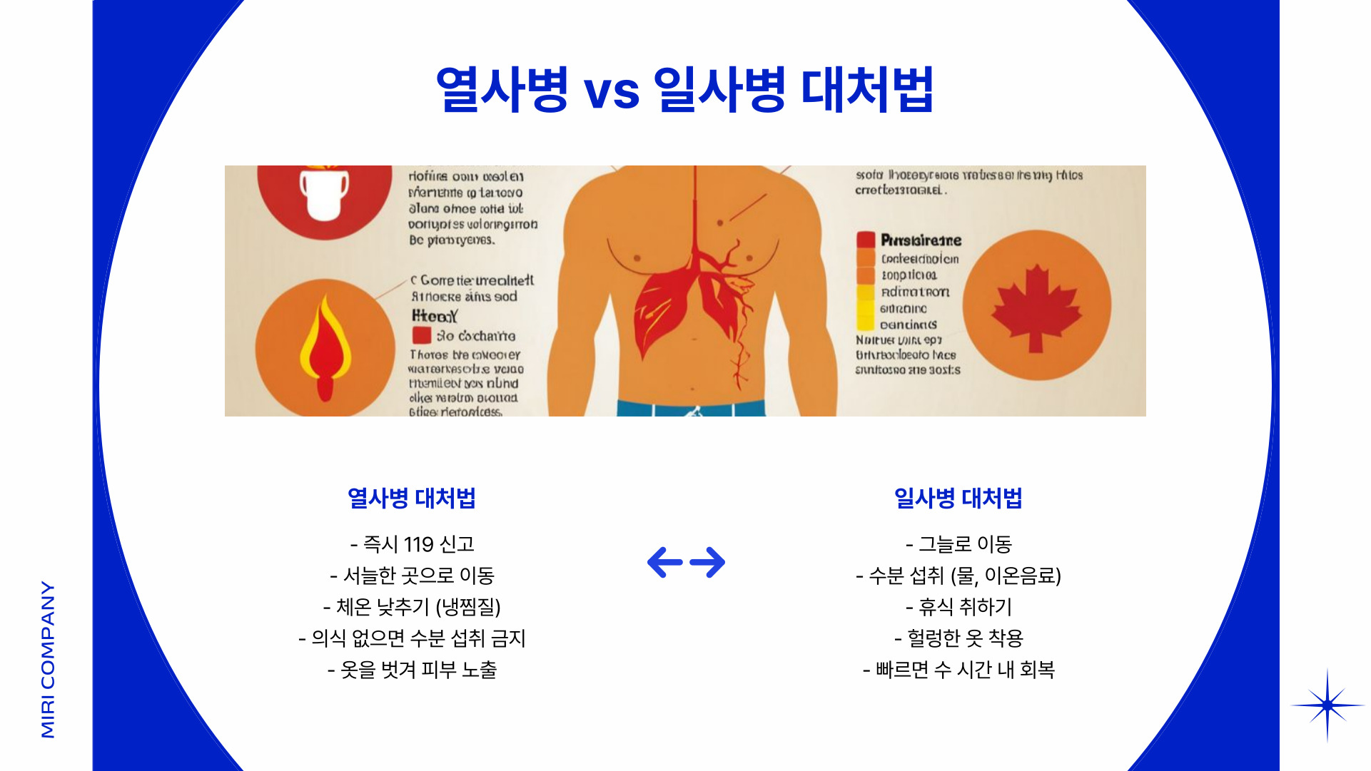 열사병과 일사병의 차이