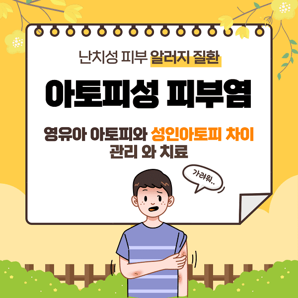 아토피성 피부염에 대하여