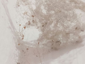 비염 원인 - 집먼지 진드기