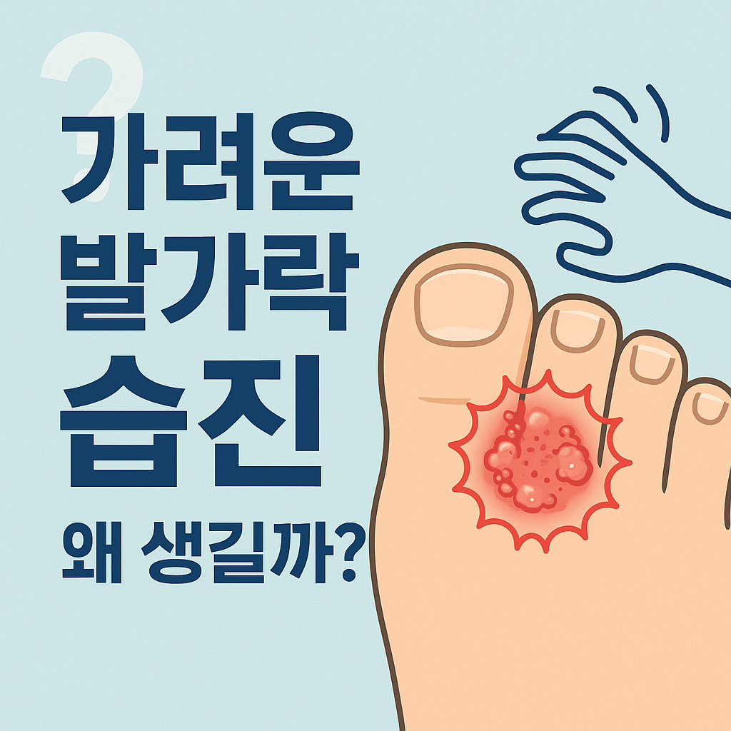 가려운 발가락습진 왜 생길까